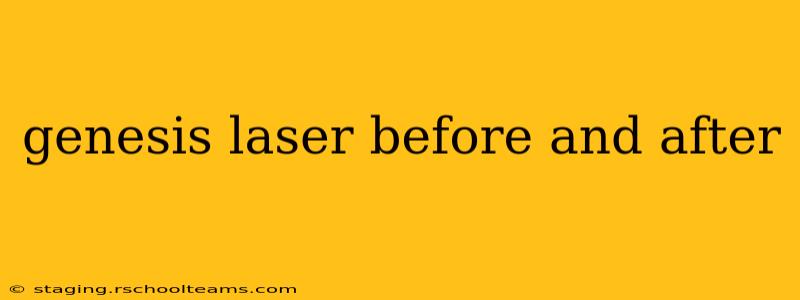 genesis laser before and after