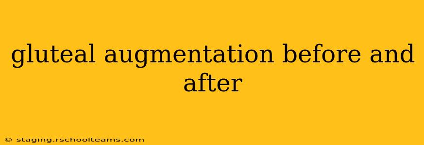 gluteal augmentation before and after