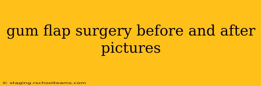 gum flap surgery before and after pictures