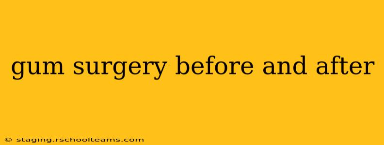 gum surgery before and after