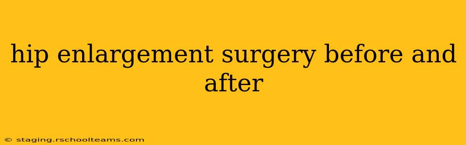 hip enlargement surgery before and after