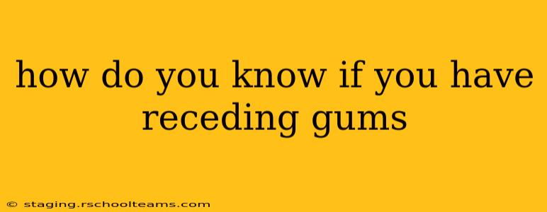 how do you know if you have receding gums