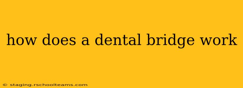 how does a dental bridge work