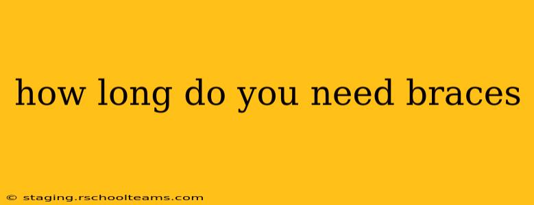 how long do you need braces