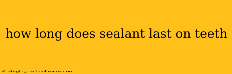 how long does sealant last on teeth