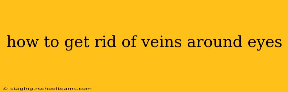 how to get rid of veins around eyes