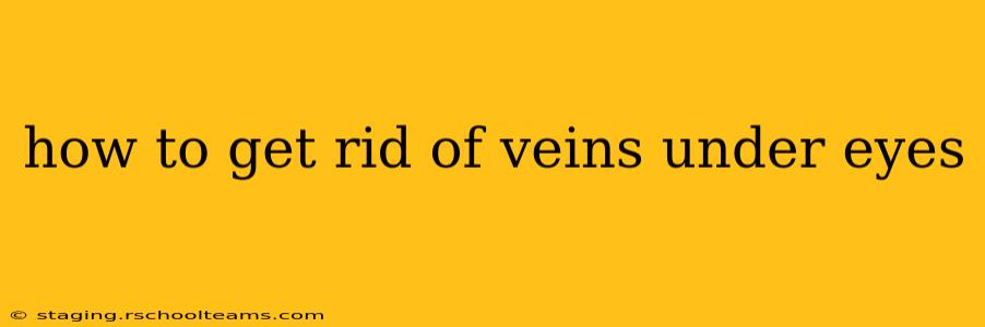 how to get rid of veins under eyes