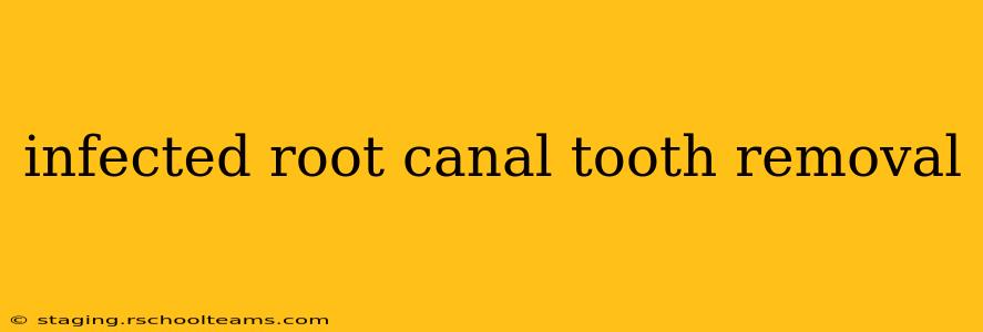infected root canal tooth removal
