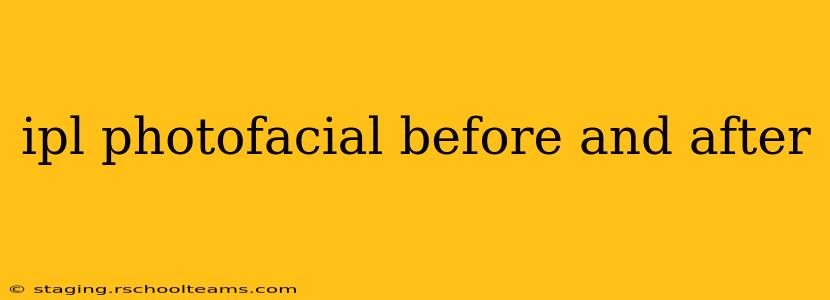 ipl photofacial before and after