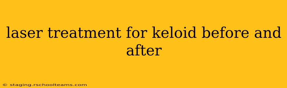 laser treatment for keloid before and after