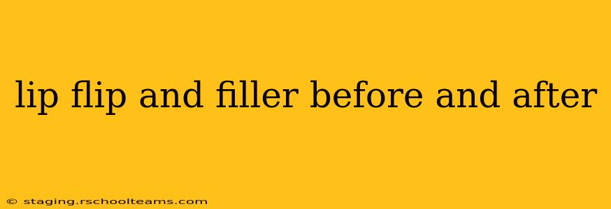 lip flip and filler before and after