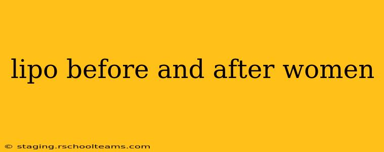 lipo before and after women