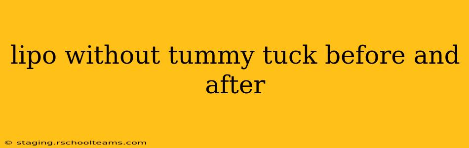 lipo without tummy tuck before and after
