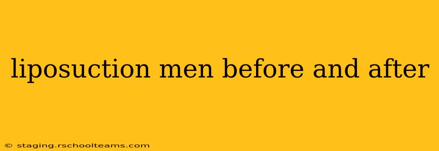 liposuction men before and after