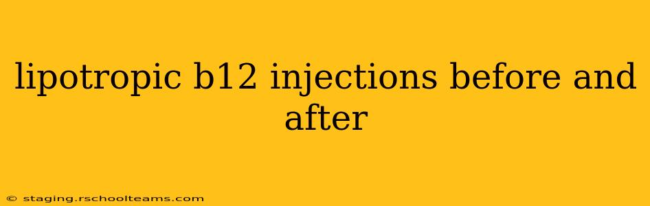 lipotropic b12 injections before and after