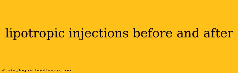 lipotropic injections before and after