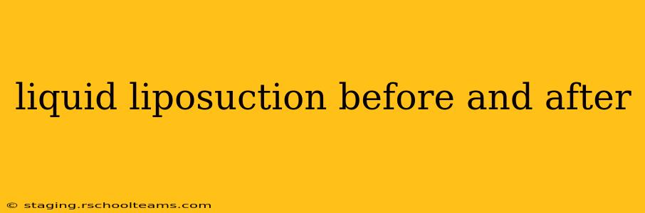 liquid liposuction before and after