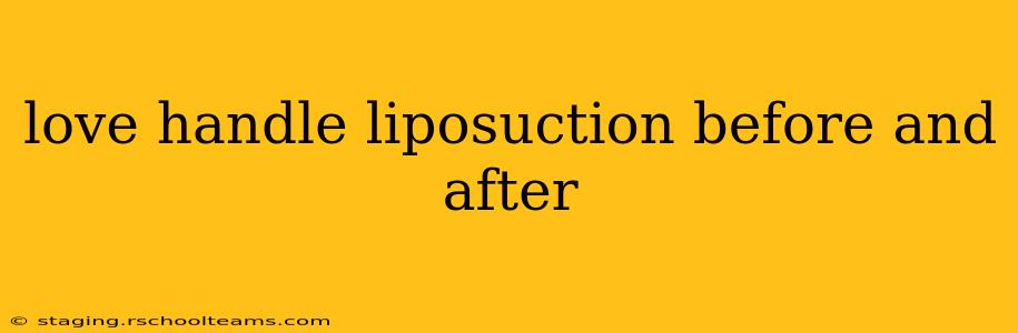 love handle liposuction before and after