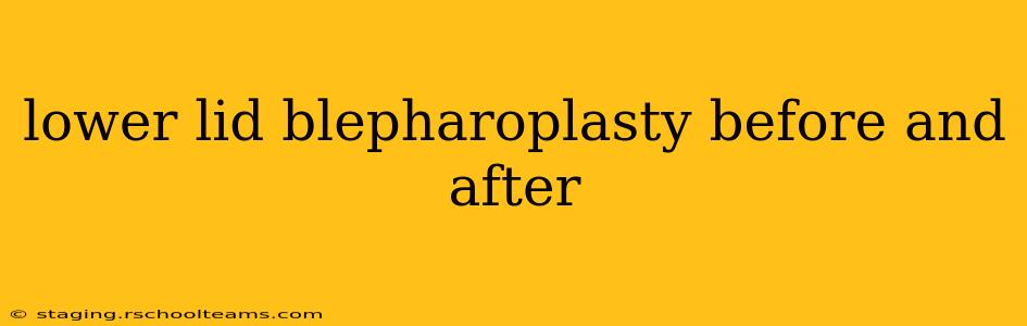 lower lid blepharoplasty before and after