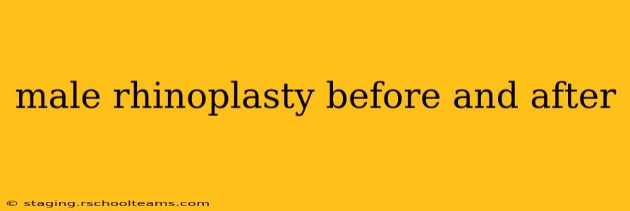 male rhinoplasty before and after