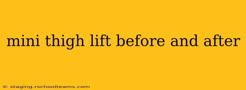 mini thigh lift before and after