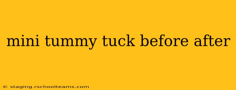 mini tummy tuck before after