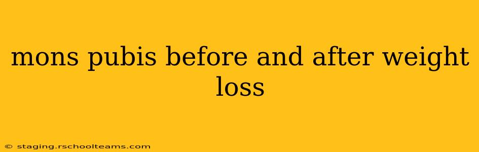 mons pubis before and after weight loss