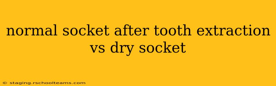 normal socket after tooth extraction vs dry socket