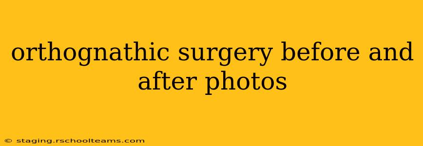orthognathic surgery before and after photos