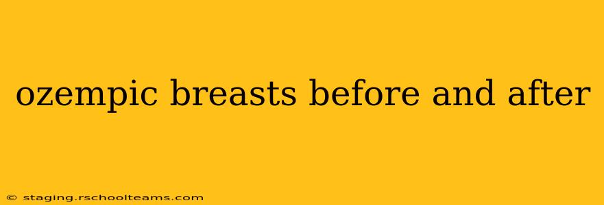 ozempic breasts before and after