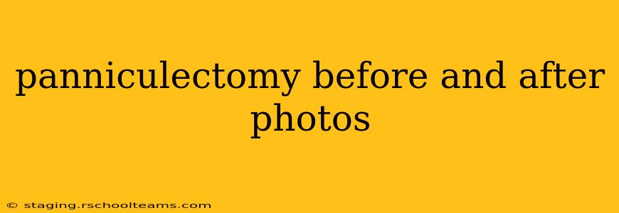 panniculectomy before and after photos