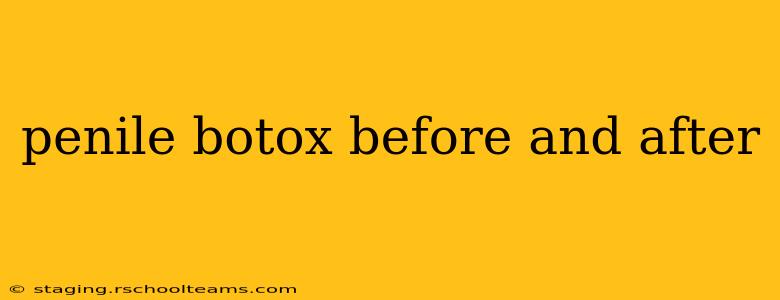 penile botox before and after