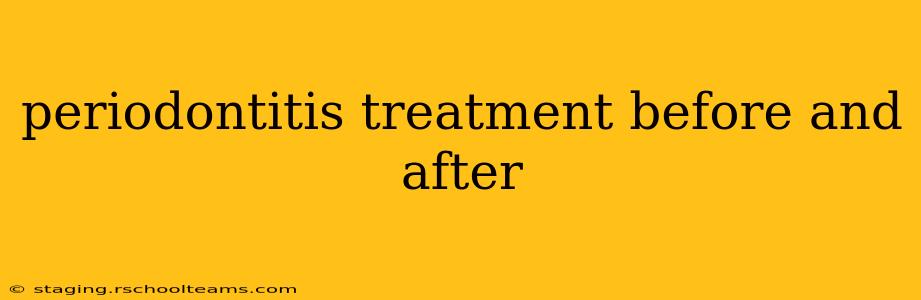 periodontitis treatment before and after