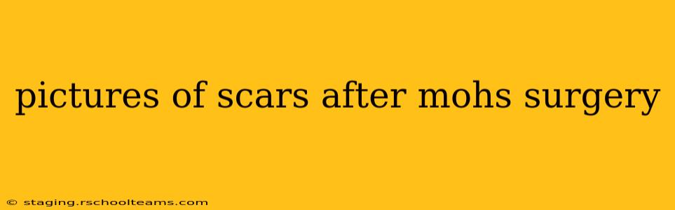 pictures of scars after mohs surgery