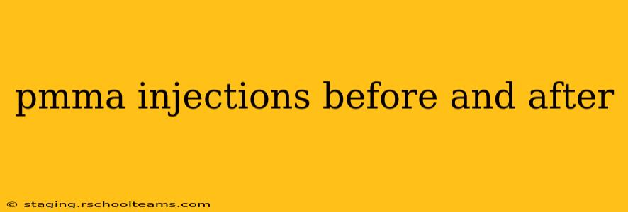 pmma injections before and after