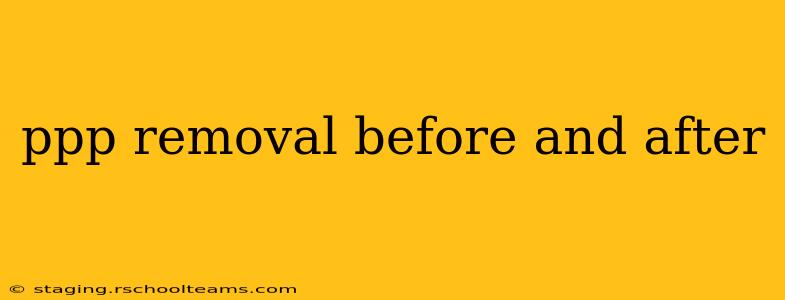 ppp removal before and after