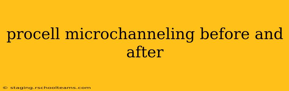 procell microchanneling before and after