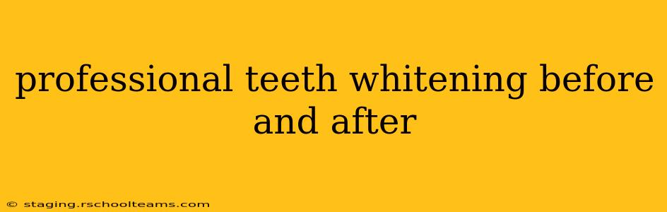 professional teeth whitening before and after
