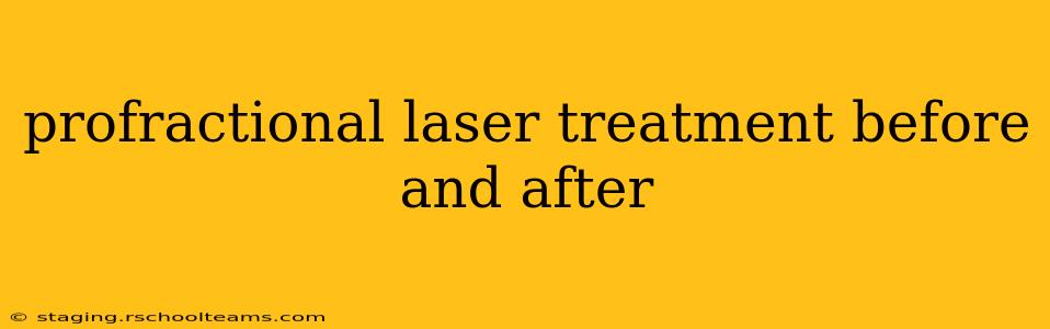 profractional laser treatment before and after