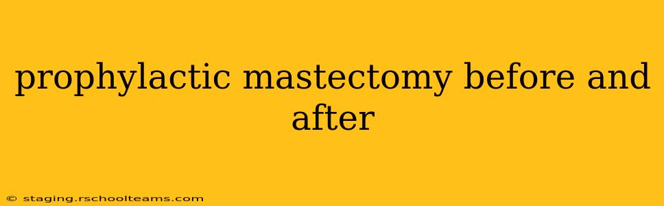 prophylactic mastectomy before and after