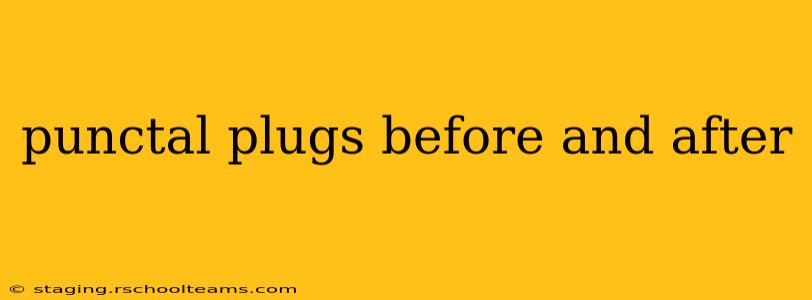 punctal plugs before and after