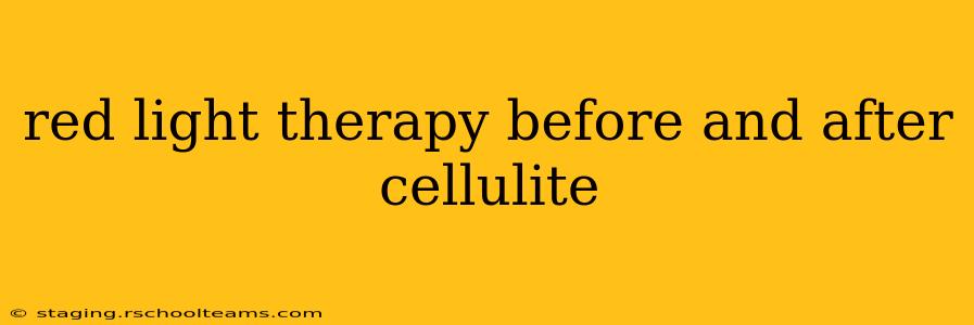 red light therapy before and after cellulite