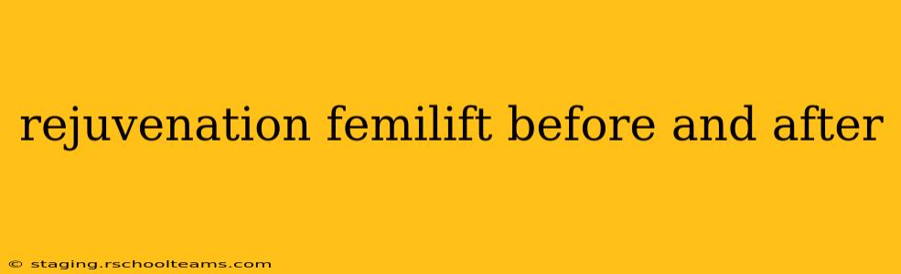 rejuvenation femilift before and after