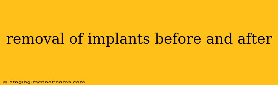 removal of implants before and after