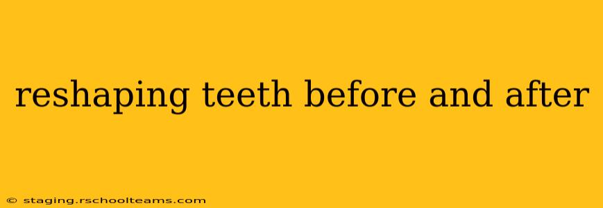 reshaping teeth before and after