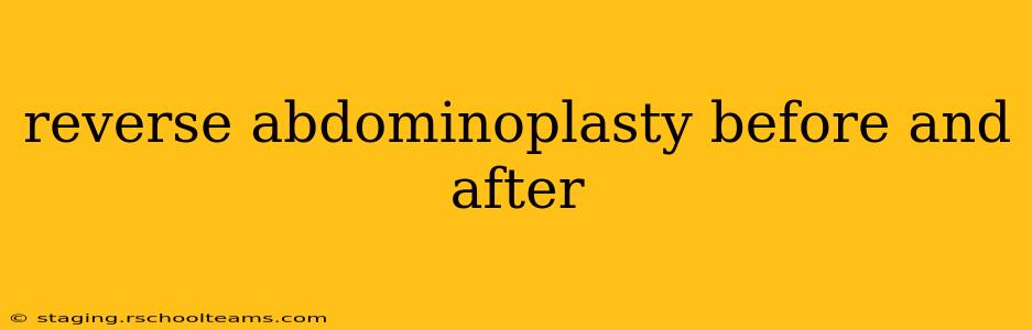 reverse abdominoplasty before and after