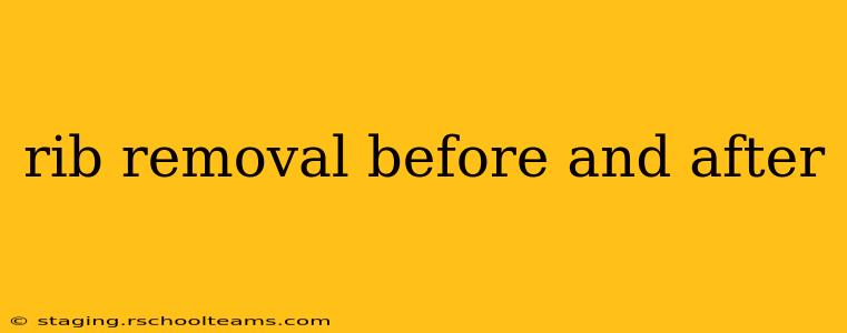rib removal before and after