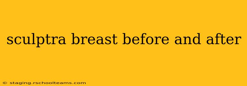 sculptra breast before and after