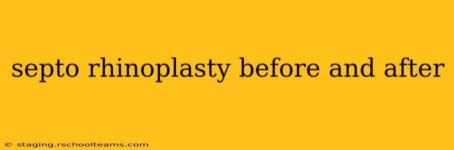 septo rhinoplasty before and after