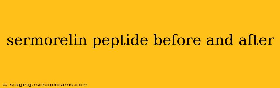 sermorelin peptide before and after